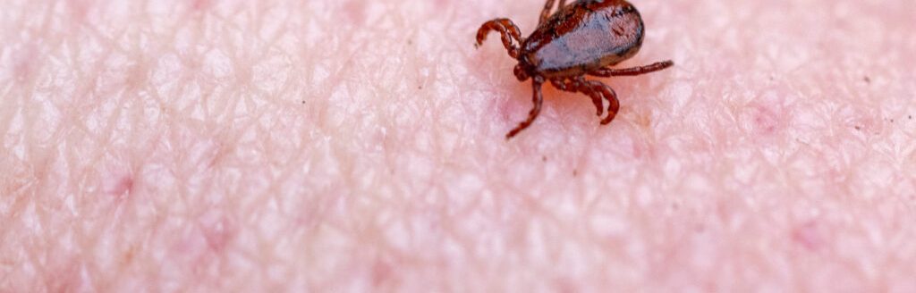 With people spending more time outdoors in the summer, all family members should be checked for ticks afterward. (Michael Miller/Texas A&M AgriLife)