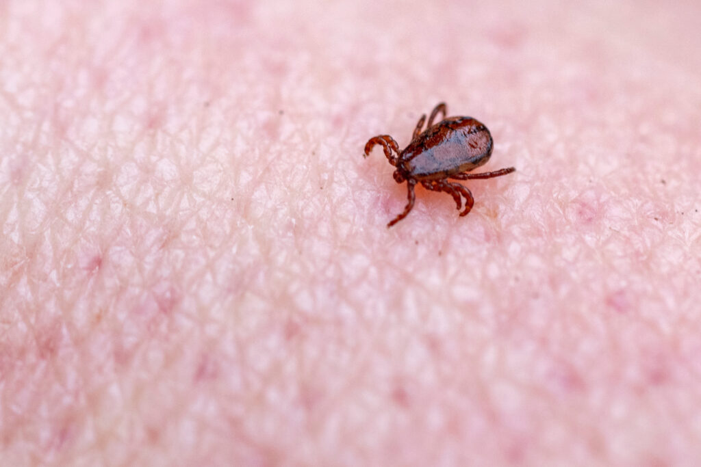 With people spending more time outdoors in the summer, all family members should be checked for ticks afterward. (Michael Miller/Texas A&M AgriLife)